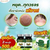 2ขวดแถมสบู่ 500 ส่งฟรี พลูคาวสกัด เม็ดซอฟเจล รณกฤต สะเก็ดเงิน ผื่นคัน ภูมิแพ้ผิวหนัง กลากเกลือน น้ำเหลืองไม่ดี ซอฟเจล อาหารเสริม