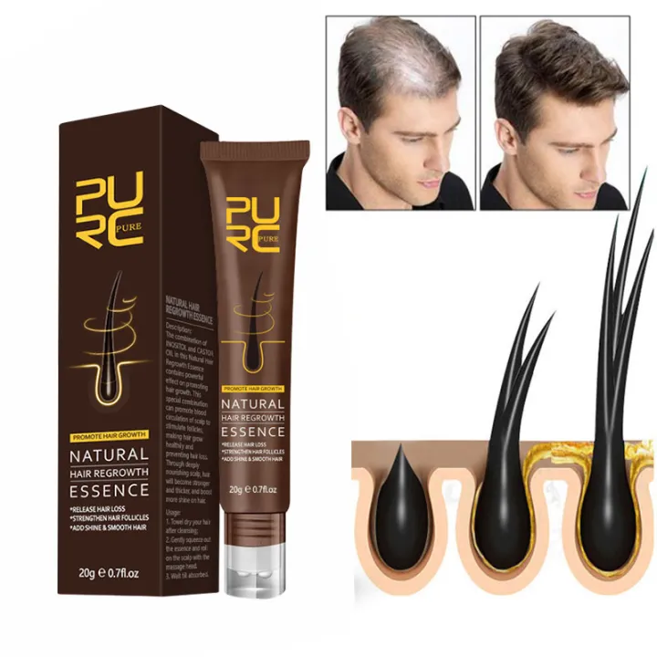 PURC Hair Growth Oil Essence Loss Treatment Serum 20g Prevent Baldness  Ginger Extract Gel Scalp Care Products Effective Thickener Hair Grower for  Men & Women Hair Care | Lazada PH