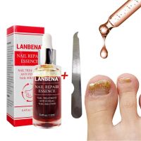 LANBENA Fungal Nail Repair Essence Serum Care Finger Toe Anti Nail Repair Footcare Fungal Nail Treatment Liquid TSLM1