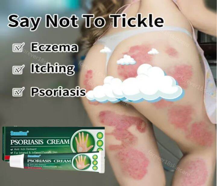 SUMIFUN ointment for itchy skin and allergy 20g For the treatment of