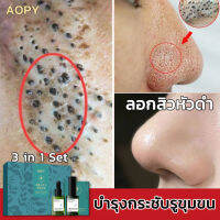 AOPY สูตรอ่อนโยน กำจัดสิวหัวดำ 3 in 1 Set ลบสิวหัวดำและสิว บำรุงกระชับรูขุมขน ขจัดผิวที่ตายแล้ว ผิวกระจ่างใส ครีมลอกสิวเสี้ยน ลอกสิวหัวดำ สิวอุดตัน ลอกได้ทั้งหน้า สูตรใหม่ สำหรับคนเป็นสิว และผิวแพ้ง่าย ( ที่ลอกสิวเสี้ยน ลอกสิวเสี้ยน มาร์คหน้าสิวเสี้ยน)