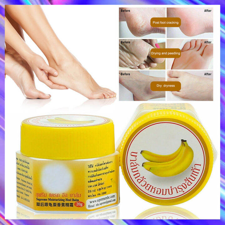 Romyse Natural Banana Peel Extract Foot Hand Skin Crack Repair Balm