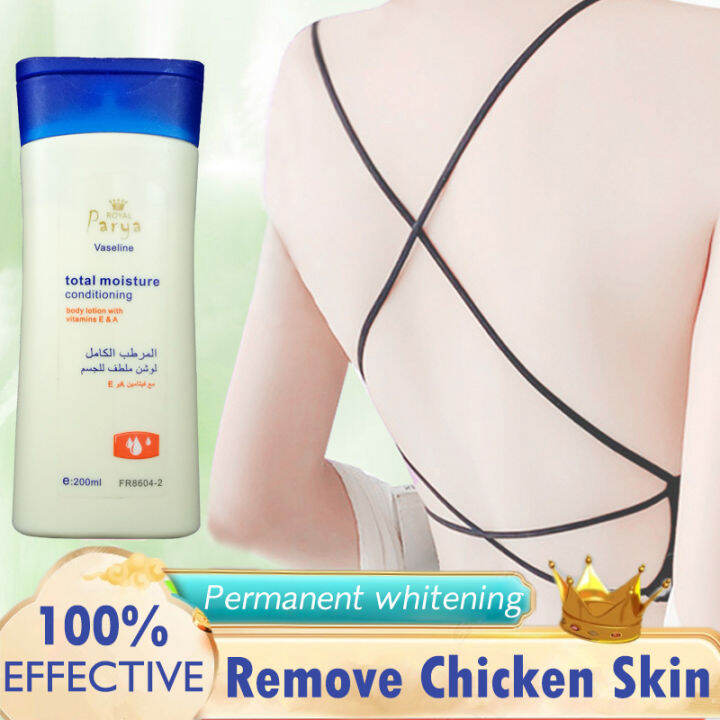 D.N.A. WhiteningBody Lotion Permanent Whitening Remove Chicken Skin Moisturizing Smoothing Anti