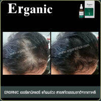 Erganic Hair Serum เซรั่มแก้ผมร่วง เพิ่มผมหนา ปลูกผม โดยแพทย์เฉพาะทางด้านเส้นผม มีหน่วยงานรัฐสนับสนุน คือ สสว. มธ. 3กล่อง