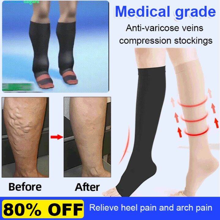 Xi Ke AntiVaricose Veins Compression Stockings Lazada PH
