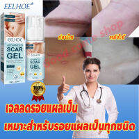 EELHOE เจลทารอยแผลเป็น 50ml ครีมทารอยแผลเป็น กำจัดรอยแตกลาย แผลไฟไหม้ น้ำร้อนลวก ซ่อมแซมผิวที่เสียหาย บำรุงผิวให้แข็งแรง ครีมกำจัดรอยแผลเป็น ครีมทารอยสิว แผลผ่าตัด ทาแผลเป็นนูน ครีมทาแผลเป็น ครีมลบแผลเป็น Scar removal cream