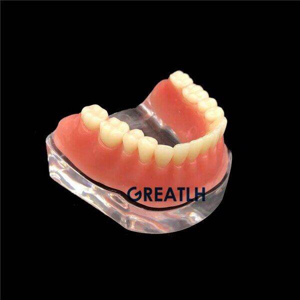 overdenture-implant-model-denture-teeth-mandibular-model-with-golden-bar-dental-teaching-model