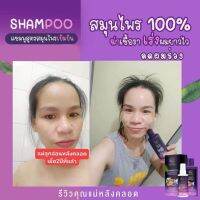 250 CODส่งฟรี เซ็ตผมดก แชมพูปลูกผม+เซรั่ม ลดผมร่วงหัวล้าน กระตุ้นการเกิดใหม่ของเส้นผมได้ดีฉีด เซรั่มได้บ่อยตามต้องการโดยไม่ต้องล้างออก