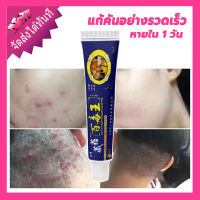 (พร้อมส่ง/ของแท้)XIANGNIU ครีมแก้คัน 20g ทาคันเชื้อรา โรคผิวหนัง สารสกัดจากพืชใช้ได้ทั้งตัว เชื้อราผิวหนัง ได้ผล 100%