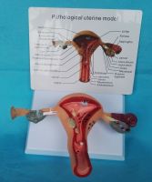 Package mail women pathological model of uterus maternity simulation pathological anatomy structure and interpretation of the uterus model