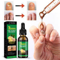 Balans【On Sale】【มีประสิทธิภาพใน7แชมพู Ginger Nail Treatment Essence Solution 30Ml ซ่อมแซมเล็บที่เสียหายได้อย่างรวดเร็ว