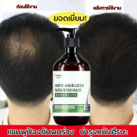 ป้องกันผมร่วง MEIDU แชมพูแก้ผมร่วง 500ml เร่งการเจริญเติบโตของเส้นผมและป้องกันผมร่วง ควบคุมความมัน ต้านเชื้อแบคทีเรีย รากผมแข็งแรง ของแท้ 100% แชมพูเร่งผมยาว ยาสระผมเร่งยาว ยาสระผมขิง แชพูแก้ผมร่วง เซรั่มแก้ผมร่วง แชมพูปลูกผมดก hair growth shampoo