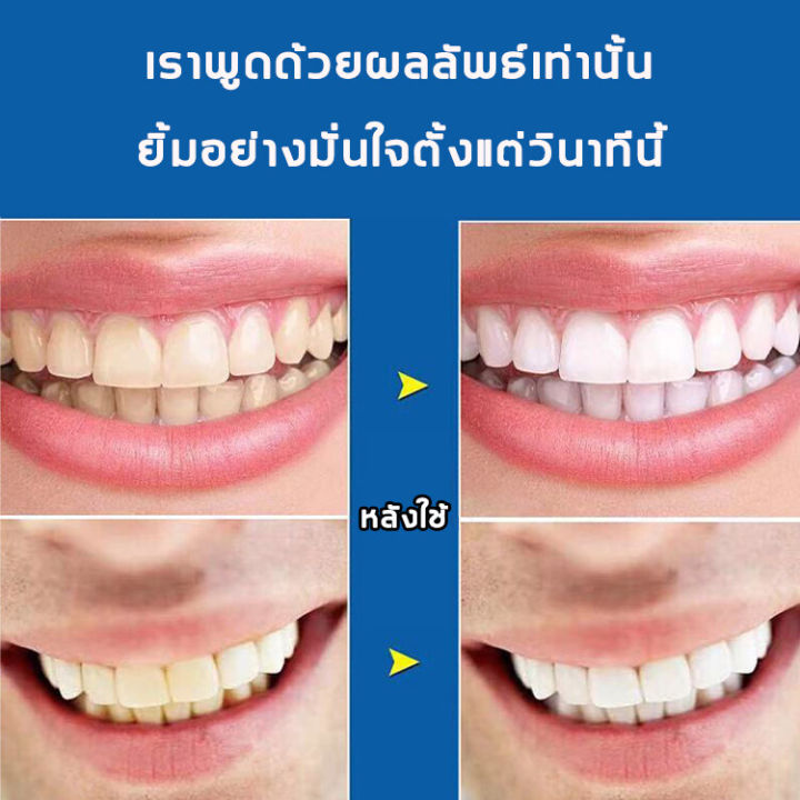 พร้อมส่ง-รุ่นใหม่-2022-กำจัดกลิ่นปาก-ขจัดกลิ่นปาก-คราบฟัน-ป้องกันฟันผุ-บำรุงฟัน-ยาสีฟัน-ขัดคราบเหลืองคราบพฟัน-ดับกลิ่นปาก-ยาสีฟัน-ขาว-ฟอกฟันขาว-น้ำยาฟอกฟันขาว-ยาแก้ปวดฟัน-ฟอกฟันขาว-ยาสีฟันขจัดปูน-ยาสี