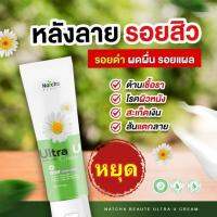 Natcha Ultra U Cream ณัชชา อัลตร้า ยู ครีม ของแท้ 100% ? 1 หลอด