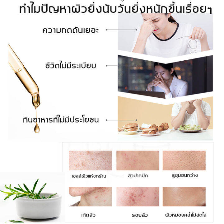 breylee-เซรั่มลดสิว17ml-เซรั่มรักษาสิว-สามารถลดสิว-บล็อกสิว-สิวไม่อักเสบ-สิวหัวขาว-สิวหัวดำ-กำจัดสิว-สิวอุดตัน-สิวผด-ไม่มีหัว-หลุมสิว-ซ่อน-ลดรอยแผลเป็นจากสิว-รอยดำจากสิว-ครีมแต้มสิว-เจลรักษาสิว-ครีมกำ