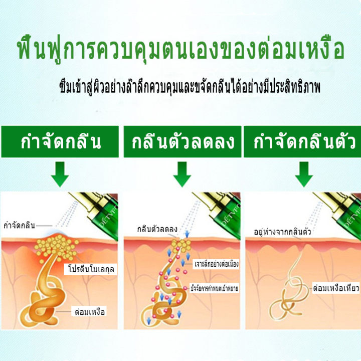 ฉีดแล้วไม่มีกลิ่นอีกต่อไป-detvfoสเปรย์ดับกลิ่นกาย-เปรย์ดับกลิ่นตัว-กลิ่นรักแร้-ดับกลิ่นตัวชาย-ลบเหงื่อ-สารระงับเหงื่อและกลิ่นตัว-สเปรย์ดับกลิ่นเท้าควบคุมกลิ่น-ดับกลิ่นรักแร้-ดับกลิ่นจักแร้-ครีมดับกลิ่