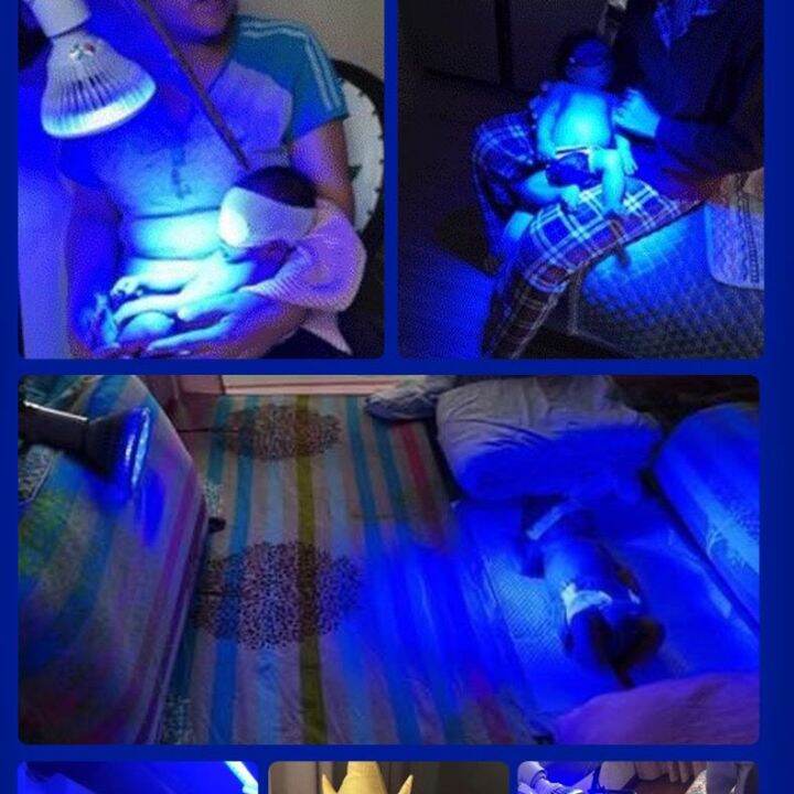 2023 Blue Light Jaundice Newborn Jaundice Detector Baby Jaundice