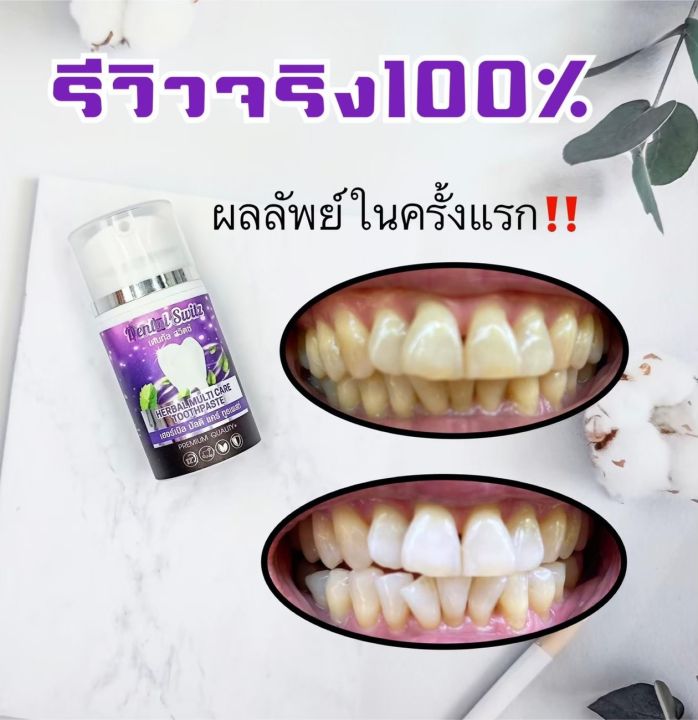 เจลฟอกฟันขาว-เจลฟอกฟันขาวdentalswitz-เจลฟอกฟัน-ลดคราบชา-กาแฟ-ฟันเหลือง