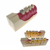 Teeth Anatomy Study Model Molar Cross Section Displacement Model Of Lower Right Posterior Teeth Model