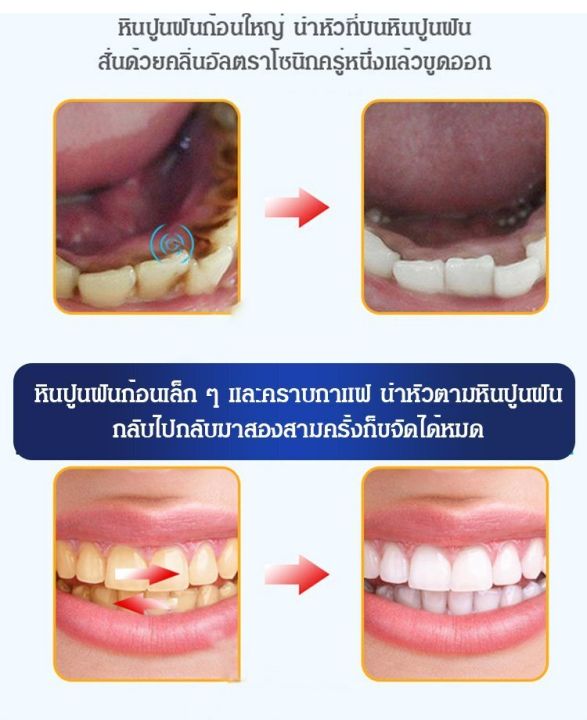 juscomart-3-ชิ้น-ยาสีฟันไวท์เทนนิ่ง-สูตรไนอาซินาไมด์โปรไบโอติก