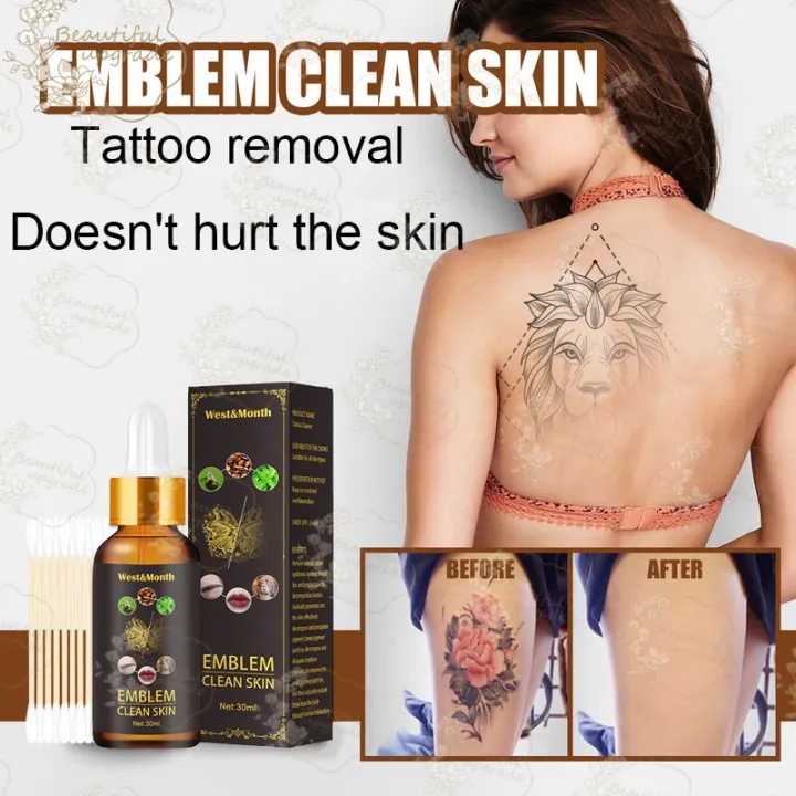 7 Tattoo Removal Creams Worth Investing On