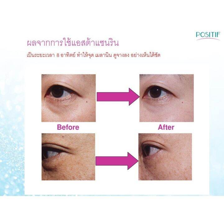 positif-flax-seed-oil-mix-blueberry-extract-lutein-zeaxanthine-โพสิทีฟ-แฟล็กซีด-จำนวน-3-กล่อง