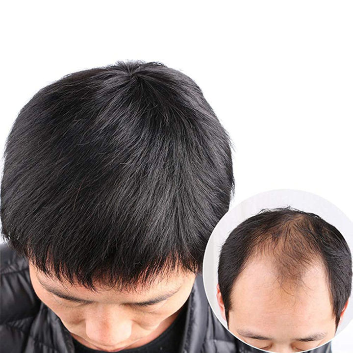 ทรงผมใหม่-วิกผมชายสั้น-hair-หล่อฉบับภาษาเกาหลีของหัวชิ้นส่วนเปลี่ยนวิกผมชายชิ้น-bald-หน้าผากผู้ชายผมแท้-ghy