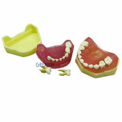 Dental Soft Gum Mini Typodont Study Model With Removable Teeth Model Dental Supplies