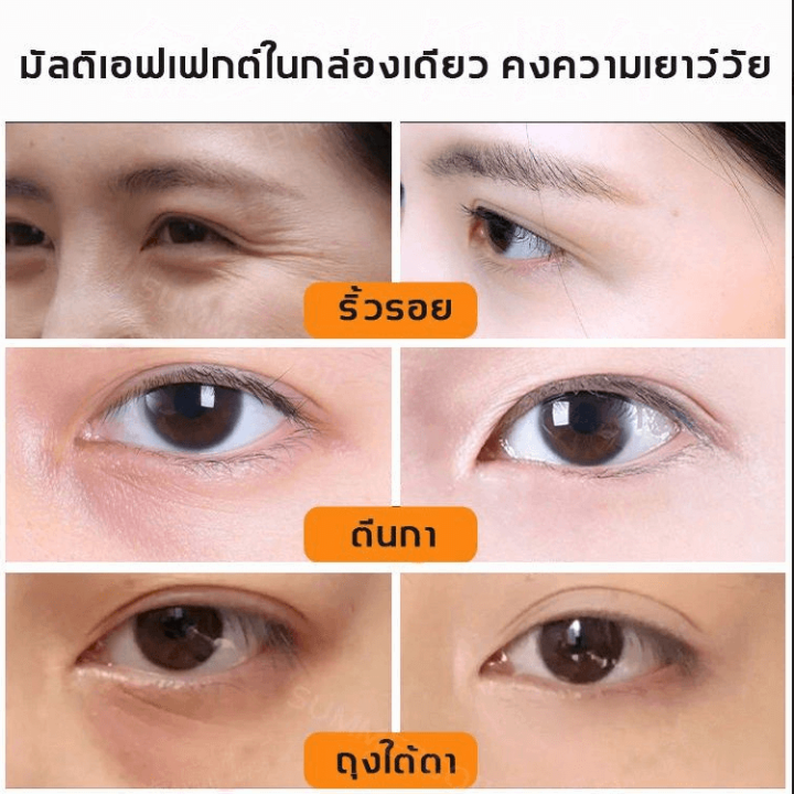 eye-cream-อายครีม-ครีมบำรุงรอบดวงตา-ครีมทาใต้ตา-ลดริ้วรอยรอบดวงตา-ลดความหมองคล้ำ-ลดใต้ตาดำ-ลบรอยตีนกา-ยกกระชับ-ลดความหมองคล้ำ