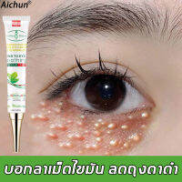 【ซื้อ 2 แถม 1】【มีสินค้าพร้อมจัดส่ง】Aichun ครีมบำรุงรอบตา ครีมทาตาดำ เม็ดไขมัน 30ml (ขอบตาดำ ครีมทารอบดวงตา รอยตีนกา ครีมลดรอยตีนกา บำรุงสายตา ครีมลดริ้วรอบดวงตา ครีมทาตาเม็ดไขมัน เซรั่มอายครีม เซรั่มทาถุงใต้ตา เซรั่มถุงใต้ตา ครีมไต้ตา)