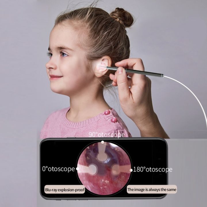 smart-ear-cleaner-endoscope-spoon-camera-ear-picker-cleaning-wax-removal-visual-earpick-wifi-mouth-nose-otoscope-support-android