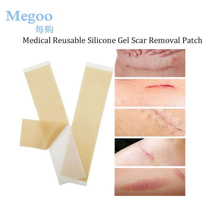 Medical Reusable Silicone Scar Removal Patch Skin Acne Scald Repair