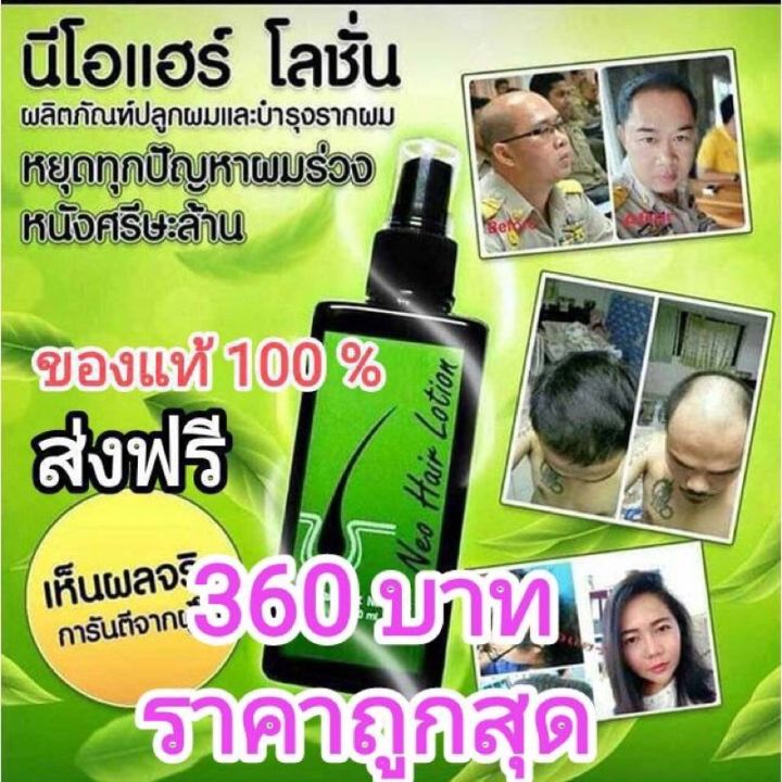 นีโอแฮร์โลชั่น-neo-hair-lotion-แบรนด์แท้-ส่งด่วน-1-ขวด-บรรจุ-120-ml-สเปรย์ปลูกผม-เซรั่มปลูกผม-ปลูกผม-ลดผมร่วง-น้ำยาปลูกผมหนา-น้ำยาปลูกผม-ปลูกผ