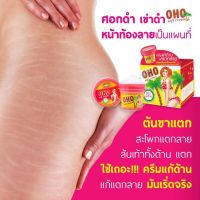 ? ครีมแก้ผิวด้าน แก้แตกลาย Oho Soft Cream โอ้โห ซอฟท์ครีม ครีมแก้ก้นลาย [ ของมีจำนวนจำกัด ]