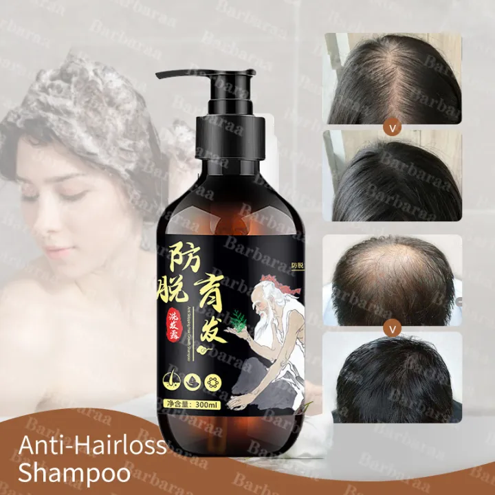 100 Original Ginger Hair Shampoo Anti Hair Loss Nourish Hair Fast Growth Shampoo Oil Control 8022