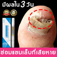 ยาเชื้อราเล็บ ยารักษาเชื้อราที่เล็บ Fungal Nail เซรั่มบำรุงเล็บ เชื้อราเล็บมือ แก้เชื้อราที่เล็บ บำรุงเล็บ ลากับเล็บเสีย ไม่ทำร้ายเล็บดี ห่างกับปัญหาเล็บ（ ซ่อมแซมเล็บ  เชื้อราที่เล็บ ยารักษาเล็บ บำรุงเล็บ ครีมบำรุงเล็บ )