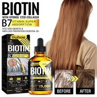 【CW】 B7 Vitamin Hair Fast Growing Oils Anti Loss Spray Scalp Treatment Men