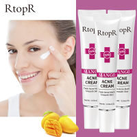 RtopR 3 ชิ้น มะม่วงรีแพร์ครีมแต้มสิว การดูแลผิวหน้า  Mango Repair Acne Cream 15 กรัม