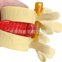 Medical human lumbar disease model lumbar spine model demonstration model orthopaedic spine