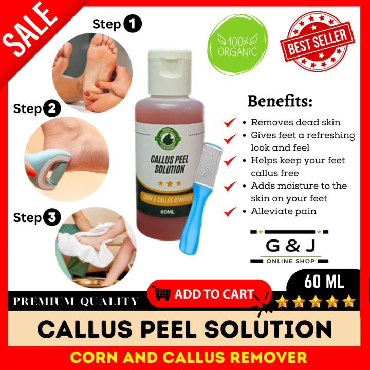 ⚡⚡CALLUS REMOVER SET 60ML KALYO OIL SOLUTION WITH CALLUS PILE GRINDER