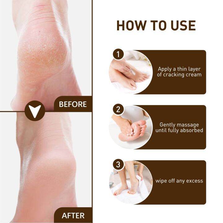 cw-herbal-anti-drying-crack-foot-cream-heel-cracked-repair-removal-dead-skin-moisturizing-nourishing-hand-feet-care-mask-15g