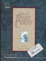 Atlas of Breast Cancer