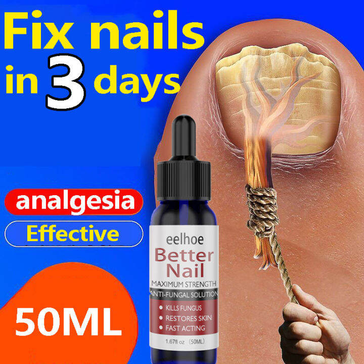 Nail fungus repair Nail repair liquid 50ml nail treatment fungal anti