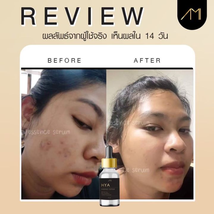 ami-hya-essence-serum-เซรั่มไฮยา-เซรั่มลดฝ้ากระ-ลดเลือนจุดด่างดำ-15ml