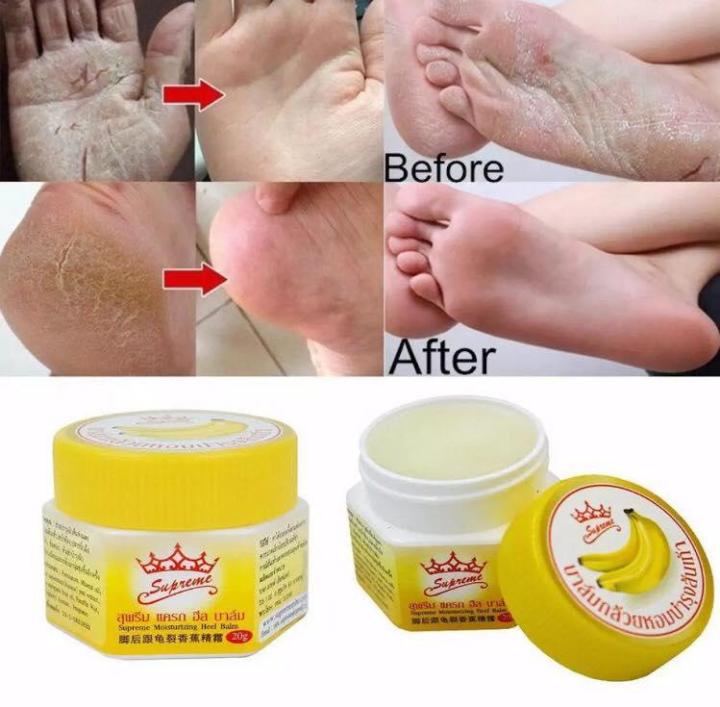 20g foot Dead Skin Remover banana oil Anti-drying crack foot cream cracked  heel repair hand