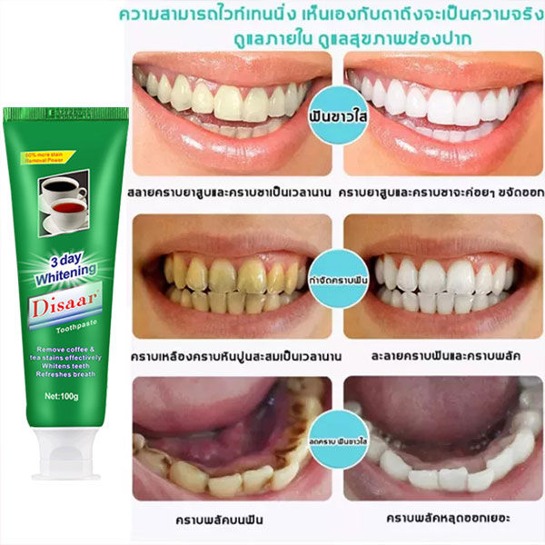 แก้ปัญหาฟันทุกอย่าง-disaar-ยาสีฟัน-บำรุงเหงือก-กำจัดกลิ่นปาก-ป้องกันฟันผุ-ขจัดคราบพลัคอย่างรวดเร็ว-ลดอาการเสียวฟัน-ฟอกฟันขาว-ยาสีฟันขจัดปูน-ยาสีฟันฟันขาว-ยาสีฟันลดกลิ่น-ยาสีฟันแก้ปวด-ยาสีฟันสมุนไพร-ยา