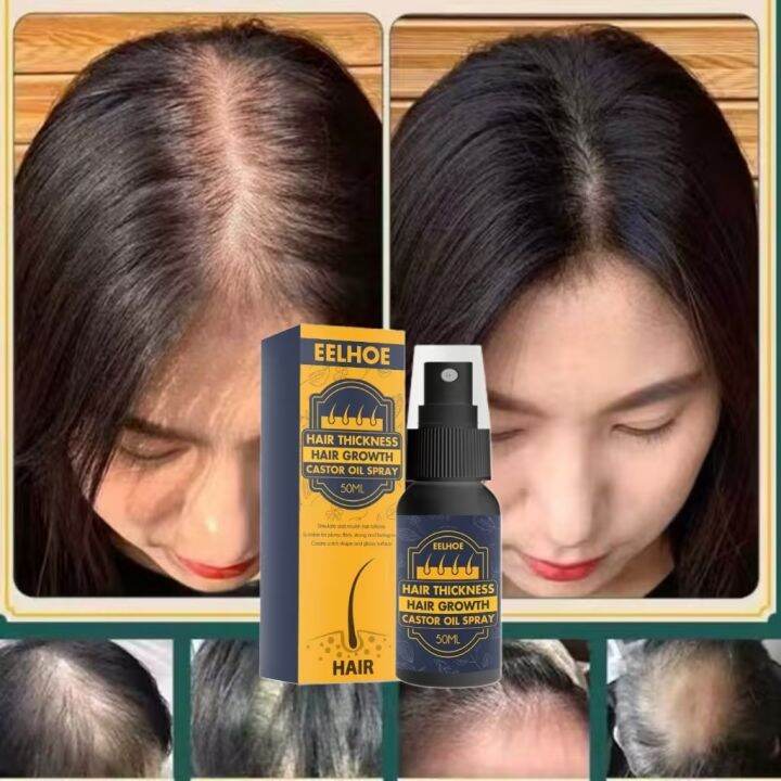100 Natural Ginger Hair Serum Hair Grower Fast Long Hair Treatment 100 Natural Ginger Hair Serum Hair Grower Fast Long Hair Treatment