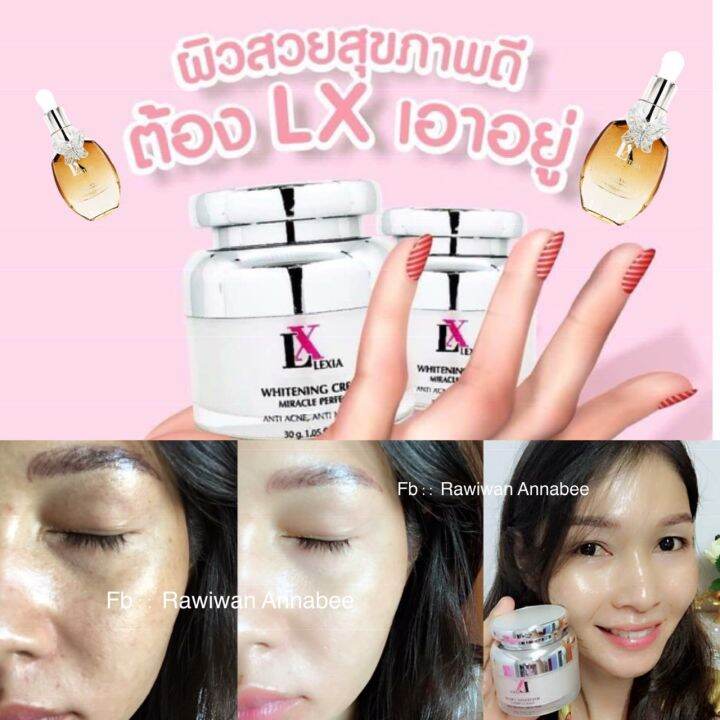 ครีมบำรุงผิวหน้า-lx-ไวเทนนิ่งครีม-1-กระปุก-ขนาด30กรัม-ราคา-750