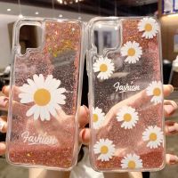 ¤∋▥ เคสโทรศัพท์มือถือลายกลิตเตอร์สําหรับ Huawei P 10 Lite P 20 Pro P 30 P 40 Nova 3i 7 I Mate 20 30