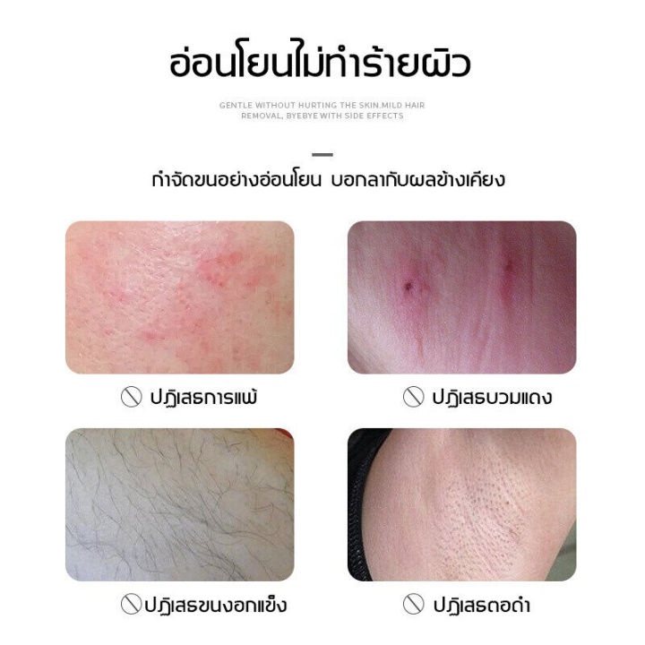 สเปรย์กำจัดขน-มูสกำจัดขน-มูสกำจัดขนถาวร-ครีมกำจัดขน-ครีมกำจัดขนขาครีมแว๊กขนรักแร้-ครีมกำจัดขนลับ-แว๊กกำจัดขน-ครีมกำจั-ขนรักแร้-กำจัดขนอย่างอ่อนโยน-ไม่ทำร้ายผิว-ยับยั้งขนขึ้นใหม่-ไม่มีร่องรอย